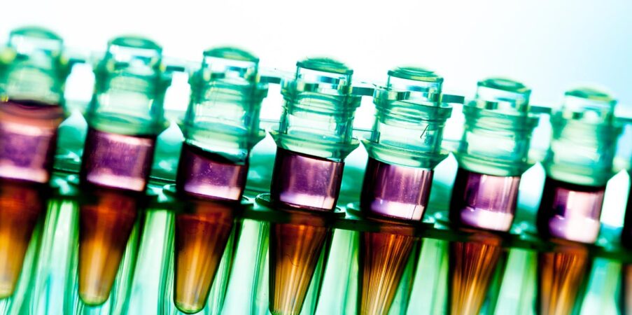 Trucheck™ Intelli cancer screening blood test